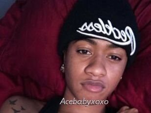 Acebabyxoxo